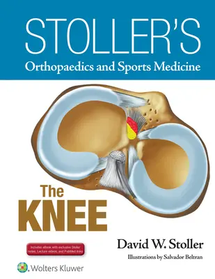 Orthopédie et médecine du sport de Stoller : The Knee : Includes Stoller Lecture Videos and Stoller Notes - Stoller's Orthopaedics and Sports Medicine: The Knee: Includes Stoller Lecture Videos and Stoller Notes