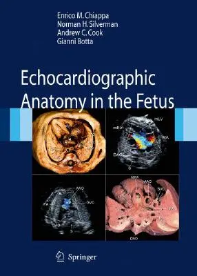 Anatomie échocardiographique chez le fœtus [Avec DVD] - Echocardiographic Anatomy in the Fetus [With DVD]