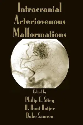 Malformations artérioveineuses intracrâniennes - Intracranial Arteriovenous Malformations