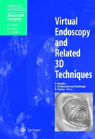 Endoscopie virtuelle et techniques 3D connexes - Virtual Endoscopy and Related 3D Techniques