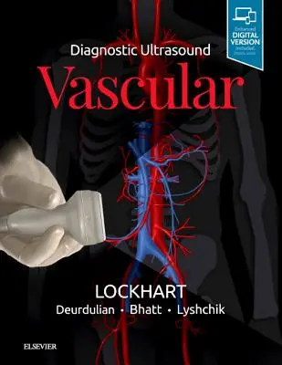 Échographie diagnostique : L'échographie vasculaire - Diagnostic Ultrasound: Vascular