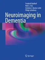 La neuro-imagerie dans la démence - Neuroimaging in Dementia