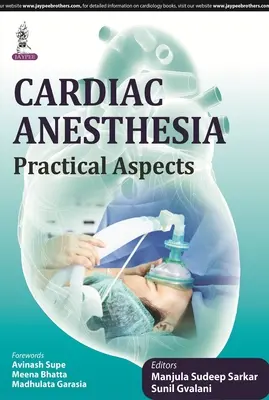 Anesthésie cardiaque : Aspects pratiques - Cardiac Anesthesia: Practical Aspects