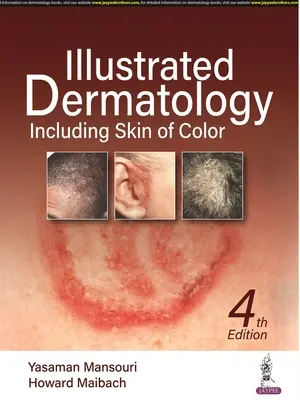 Dermatologie illustrée - y compris les peaux de couleur - Illustrated Dermatology - Including Skin of Colour