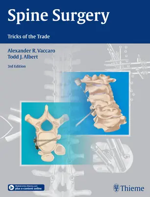Chirurgie de la colonne vertébrale : Les astuces du métier - Spine Surgery: Tricks of the Trade