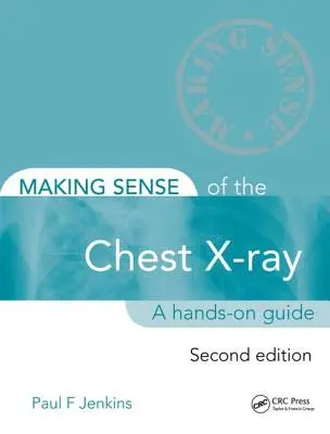 Comprendre la radiographie du thorax : Un guide pratique - Making Sense of the Chest X-Ray: A Hands-On Guide