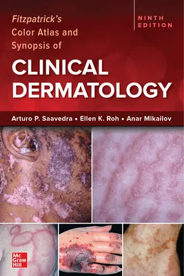 Fitzpatrick's Color Atlas and Synopsis of Clinical Dermatology, neuvième édition - Fitzpatrick's Color Atlas and Synopsis of Clinical Dermatology, Ninth Edition