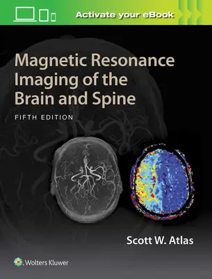 Imagerie par résonance magnétique du cerveau et de la colonne vertébrale - Magnetic Resonance Imaging of the Brain and Spine