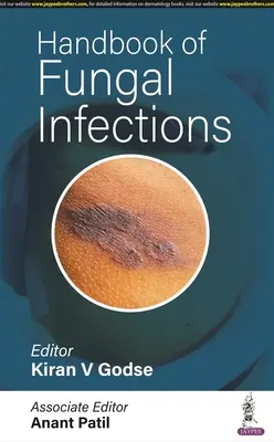 Manuel des infections fongiques - Handbook of Fungal Infections