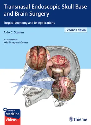 Chirurgie endoscopique transnasale de la base du crâne et du cerveau : Anatomie chirurgicale et ses applications - Transnasal Endoscopic Skull Base and Brain Surgery: Surgical Anatomy and Its Applications