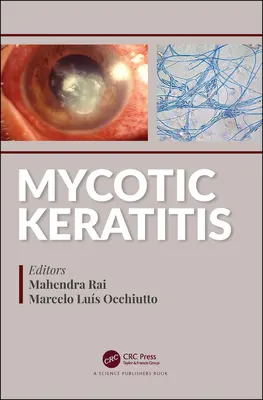 Kératite mycosique - Mycotic Keratitis