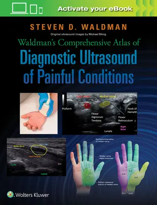 Atlas complet de Waldman sur l'échographie diagnostique des affections douloureuses - Waldman's Comprehensive Atlas of Diagnostic Ultrasound of Painful Conditions