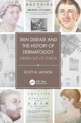 Les maladies de la peau et l'histoire de la dermatologie : L'ordre dans le chaos - Skin Disease and the History of Dermatology: Order Out of Chaos