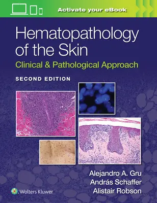Hématopathologie de la peau : Approche clinique et pathologique - Hematopathology of the Skin: Clinical & Pathological Approach