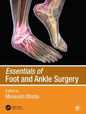 L'essentiel de la chirurgie du pied et de la cheville - Essentials of Foot and Ankle Surgery