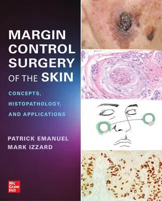 Chirurgie de contrôle des marges de la peau : Concepts, histopathologie et applications - Margin Control Surgery of the Skin: Concepts, Histopathology, and Applications