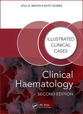 Hématologie clinique : Cas cliniques illustrés - Clinical Haematology: Illustrated Clinical Cases