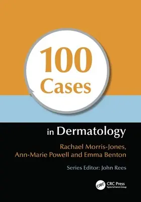 100 cas de dermatologie - 100 Cases in Dermatology