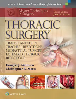 Master Techniques in Surgery : Chirurgie thoracique : Transplantation, résections trachéales, tumeurs médiastinales, résections thoraciques étendues - Master Techniques in Surgery: Thoracic Surgery: Transplantation, Tracheal Resections, Mediastinal Tumors, Extended Thoracic Resections