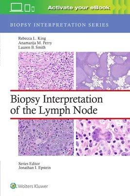 Interprétation de la biopsie du ganglion lymphatique - Biopsy Interpretation of the Lymph Node