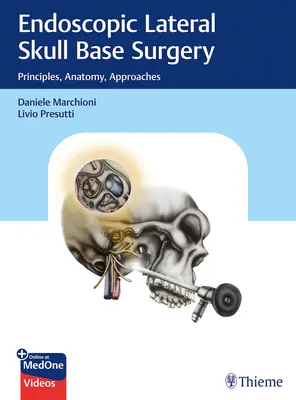 Chirurgie endoscopique latérale de la base du crâne : Principes, anatomie, approches - Endoscopic Lateral Skull Base Surgery: Principles, Anatomy, Approaches
