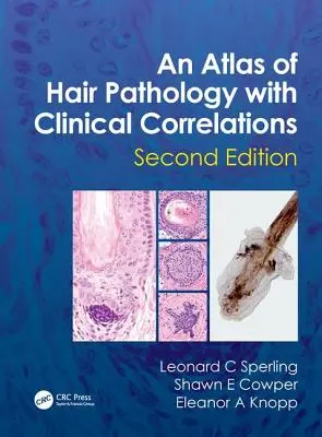 Atlas de la pathologie capillaire avec corrélations cliniques - An Atlas of Hair Pathology with Clinical Correlations