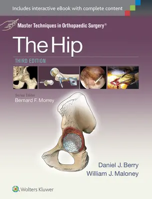 Techniques maîtresses en chirurgie orthopédique : La hanche - Master Techniques in Orthopaedic Surgery: The Hip