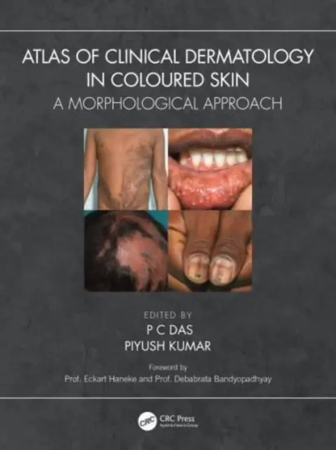 Atlas de dermatologie clinique des peaux colorées : Une approche morphologique - Atlas of Clinical Dermatology in Coloured Skin: A Morphological Approach