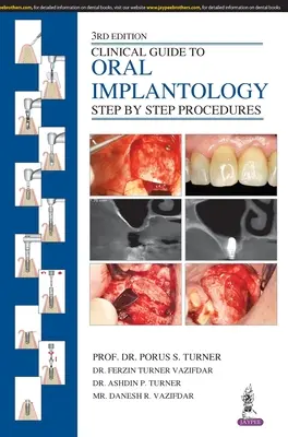 Guide clinique de l'implantologie orale : Procédures pas à pas - Clinical Guide to Oral Implantology: Step by Step Procedures