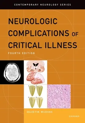 Complications neurologiques de la maladie grave - Neurologic Complications of Critical Illness