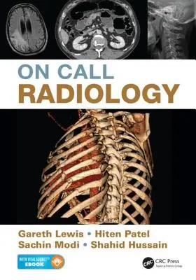 Radiologie de garde - On Call Radiology