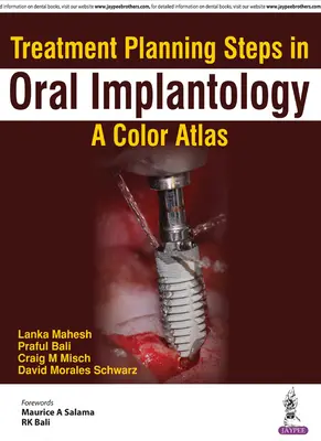 Étapes de la planification du traitement en implantologie orale : Un atlas en couleur - Treatment Planning Steps in Oral Implantology: A Color Atlas