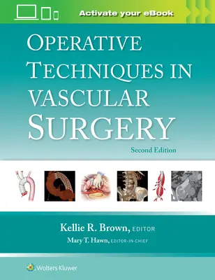 Techniques opératoires en chirurgie vasculaire - Operative Techniques in Vascular Surgery