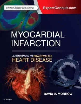 Infarctus du myocarde : Un compagnon pour la maladie cardiaque de Braunwald - Myocardial Infarction: A Companion to Braunwald's Heart Disease