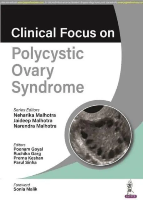 Focus clinique sur le syndrome des ovaires polykystiques - Clinical Focus on Polycystic Ovary Syndrome