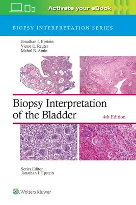 Interprétation de la biopsie de la vessie - Biopsy Interpretation of the Bladder