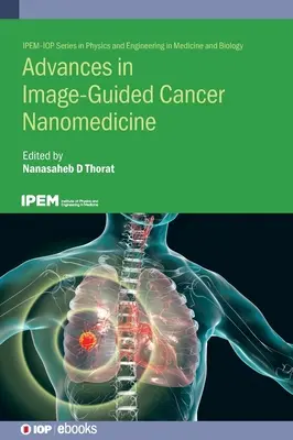 Progrès de la nanomédecine cancéreuse guidée par l'image - Advances in Image-Guided Cancer Nanomedicine