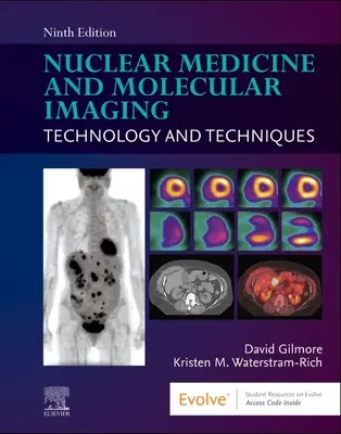 Médecine nucléaire et imagerie moléculaire : Technologie et techniques - Nuclear Medicine and Molecular Imaging: Technology and Techniques