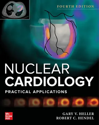 Cardiologie nucléaire : Applications pratiques, quatrième édition - Nuclear Cardiology: Practical Applications, Fourth Edition