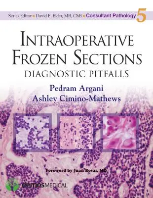 Coupes congelées peropératoires : Les pièges du diagnostic - Intraoperative Frozen Sections: Diagnostic Pitfalls