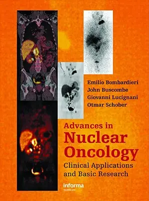 Progrès en oncologie nucléaire: : Diagnostic et thérapie - Advances in Nuclear Oncology:: Diagnosis and Therapy