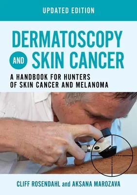 Dermatoscopie et cancer de la peau, édition mise à jour - Un manuel pour les chasseurs de cancer de la peau et de mélanome - Dermatoscopy and Skin Cancer, updated edition - A handbook for hunters of skin cancer and melanoma