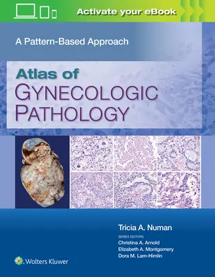 Atlas de pathologie gynécologique : Une approche basée sur les schémas - Atlas of Gynecologic Pathology: A Pattern-Based Approach