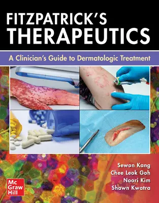 Fitzpatrick's Therapeutics : Guide du clinicien pour le traitement dermatologique - Fitzpatrick's Therapeutics: A Clinician's Guide to Dermatologic Treatment