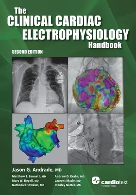 Manuel d'électrophysiologie cardiaque clinique, deuxième édition - The Clinical Cardiac Electrophysiology Handbook, Second Edition