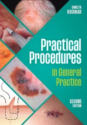 Practical Procedures in General Practice, second edition (Kochhar Suneeta (GP in East Sussex))