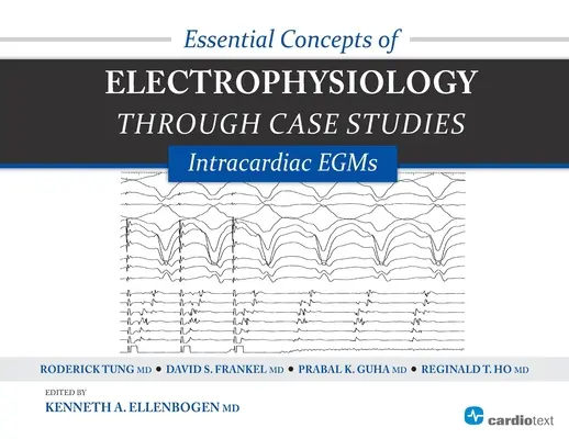 Concepts essentiels de l'électrophysiologie à travers des études de cas : EGM intracardiaques : EGM intracardiaques - Essential Concepts of Electrophysiology Through Case Studies: Intracardiac EGMs: Intracardiac EGMs