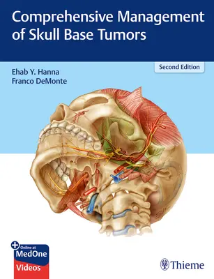 Prise en charge globale des tumeurs de la base du crâne - Comprehensive Management of Skull Base Tumors