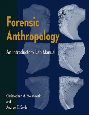 Anthropologie médico-légale : Un manuel d'introduction au laboratoire - Forensic Anthropology: An Introductory Lab Manual