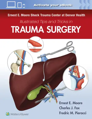 Ernest E. Moore Shock Trauma Center at Denver Health Conseils et astuces illustrés en chirurgie traumatologique - Ernest E. Moore Shock Trauma Center at Denver Health Illustrated Tips and Tricks in Trauma Surgery